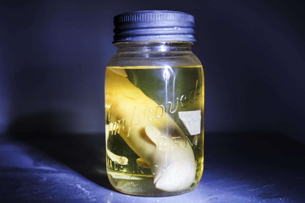 A yellowish liquid-filled jar with a black lid, containing a preserved pale object that appears to be a biological specimen, sits on a metallic surface. The jar is marked